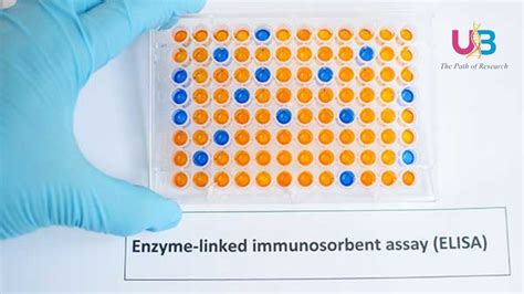 elisa test vitamin|how to use elisa scanner.